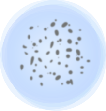 希瑪眼科中心_飛蚊症