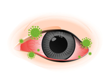 希瑪眼科中心_病毒性結膜炎