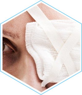 希瑪眼科中心_青光眼高危人士_眼睛創傷