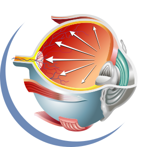 希瑪眼科中心_慢性青光眼