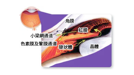 希瑪眼科中心_虹膜睫狀體炎繼發性青光眼