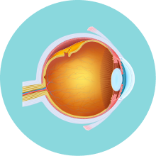 希瑪眼科中心_視網膜脫落